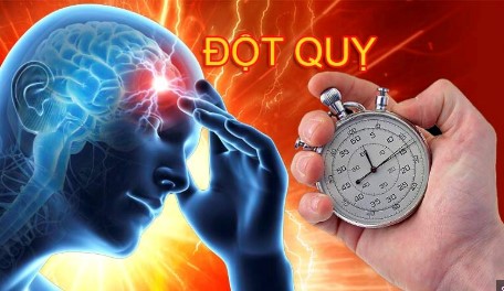 Đột Quỵ Gia Tăng Ở Người Trẻ: Nguyên Nhân và Dấu Hiệu Nhận Biết