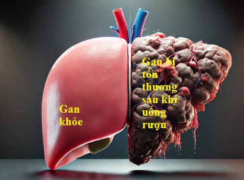 Uống nhiều Rượu Bia phải làm sao? Bí quyết bảo vệ Gan hiệu quả